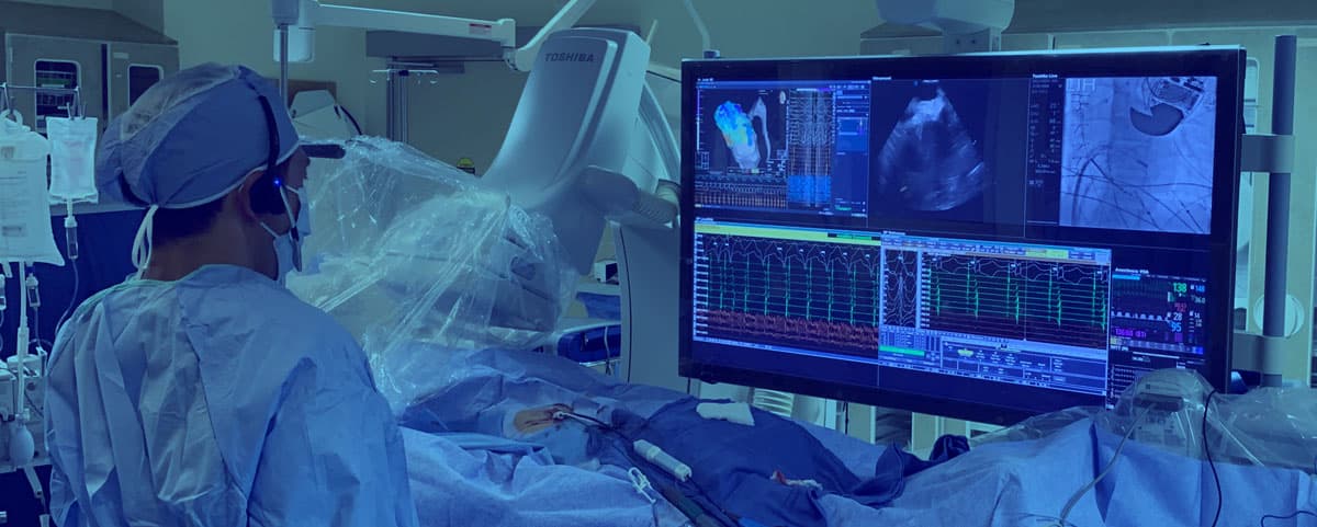 vCLAS Catheter